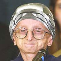 Gerçek bir Progeria vakası